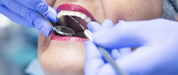 Best Emergency Treatment for Dental Infections or Abscesses in College Place, WA